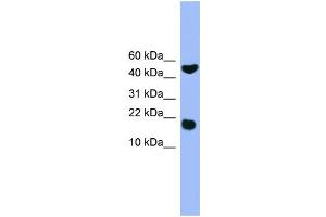 WB Suggested Anti-RWDD1  Antibody Titration: 0.