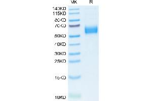 Mouse IL-1R1 on Tris-Bis PAGE under reduced condition. (IL1R1 Protein (AA 20-338) (His tag))