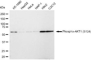 Western blotting analysis using Phospho-AKT1 (S124) antibody (ABIN7800784).