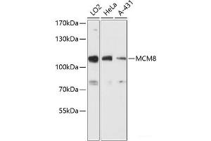 Western blot analysis of extracts of various cell lines using MCM8 Polyclonal Antibody at dilution of 1:3000. (MCM8 抗体)