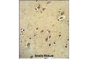 Immunohistochemistry (Paraffin-embedded Sections) (IHC (p)) image for anti-DIRAS Family, GTP-Binding RAS-Like 3 (DIRAS3) antibody (ABIN652072)