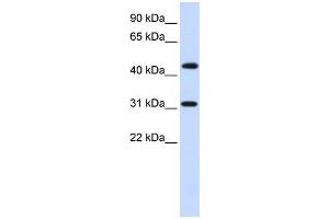 Human Brain; WB Suggested Anti-ZNF684 Antibody Titration: 0. (ZNF684 抗体  (N-Term))