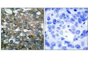 Immunohistochemical analysis of paraffin-embedded human breast carcinoma tissue using (EGFR 抗体)