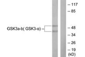 Western blot analysis of extracts from 293 cells, treated with TNF-a 20ng/ml 30', using GSK3 alpha/beta (Ab-279/216) Antibody. (GSK3 alpha/beta 抗体  (AA 246-295))