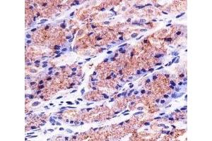 Immunohistochemistry (IHC) image for anti-Prohibitin (PHB) antibody (ABIN3028947)