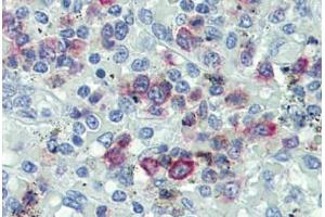 Human Spleen: Formalin-Fixed, Paraffin-Embedded (FFPE) (FASL 抗体  (AA 82-145))