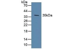 Detection of DKK1 in Porcine Brain Tissue using Polyclonal Antibody to Dickkopf Related Protein 1 (DKK1) (DKK1 抗体  (AA 33-266))