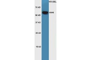 Lane 1: A549 cell lysates probed with Rabbit Anti-OCT2 Polyclonal Antibody, Unconjugated  at 1:5000 for 90 min at 37˚C. (Oct-2 抗体  (AA 11-100))