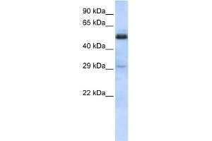 WB Suggested Anti-SCML1 Antibody Titration:  0. (SCML1 抗体  (Middle Region))