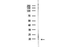 Western blot analysis of lysates from PC12 cells(heat-shock,45 min treatment), using GPSM3 Antibody at 1/1000 dilution.