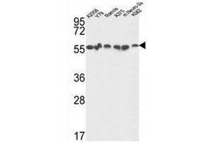 GPI Antibody (C-term) western blot analysis in A2058,Y79,Ramos,A375,K562 and mouse Neuro-2a cell line lysates (35µg/lane). (GPI 抗体  (C-Term))