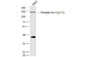 K562 lysates probed with Phospho-Bcr (Tyr177) Polyclonal Antibody, Unconjugated  at 1:300 dilution and 4˚C overnight incubation. (BCR 抗体  (pTyr177))