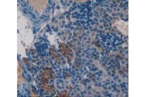 IHC-P analysis of kidney tissue, with DAB staining. (Frataxin 抗体  (AA 41-207))