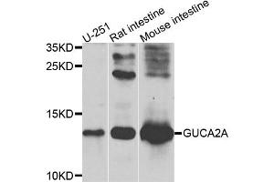 Western blot analysis of extracts of various cell lines, using GUCA2A antibody. (GUCA2A 抗体)