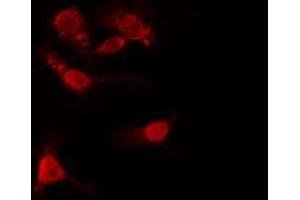 ABIN6275452 staining  HeLa cells by IF/ICC. (IQGAP1 抗体  (N-Term))