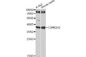 Western blot analysis of extracts of various cell lines, using CSNK2A2 antibody (ABIN6290214) at 1:1000 dilution. (CSNK2A2 抗体)