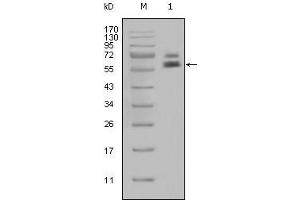 Western blot analysis using CK5 mouse mAb against Hela cell lysate (1). (Cytokeratin 5 抗体)