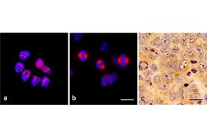 Immunocytochemistry of TPX2 using monoclonal antibody TPX2-01 in glioblastoma cell line T98G: a) interphase, b) mitosis. (TPX2 抗体)