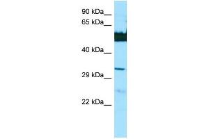 WB Suggested Anti-LGSN Antibody Titration: 1. (LGSN 抗体  (N-Term))