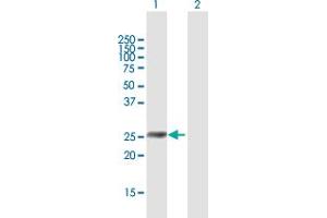 Western Blot analysis of IGFBP6 expression in transfected 293T cell line by IGFBP6 MaxPab polyclonal antibody.