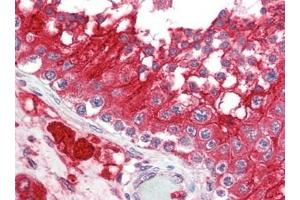 Human Testis (formalin-fixed, paraffin-embedded) stained with ACE2at 2. (ACE2 抗体  (N-Term))