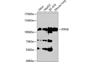 Western blot analysis of extracts of various cell lines, using ITPKB antibody (ABIN1680537, ABIN3018302, ABIN3018303 and ABIN6220431) at 1:1000 dilution. (ITPKB 抗体  (AA 1-260))