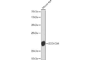 Western blot analysis of extracts of Mouse eye, using ZCCHC10 Rabbit pAb (ABIN7271545) at 1:1000 dilution. (ZCCHC10 抗体  (AA 1-100))