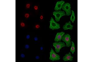 ABIN6256820 and ABIN6277498 staining Hela cells by IF/ICC. (NONO 抗体  (C-Term))
