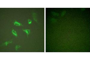 PMA + -Immunofluorescence analysis of HeLa cells, treated with PMA (125ng/ml, 30mins), using 14-3-3 ζ (Ab-58) antibody (#B0001). (14-3-3 zeta 抗体  (Ser58))