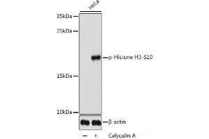 Western blot analysis of extracts of HeLa cells using Phospho-Histone H3(S10) Polyclonal Antibody at dilution of 1:1000. (Histone 3 抗体  (pSer10))