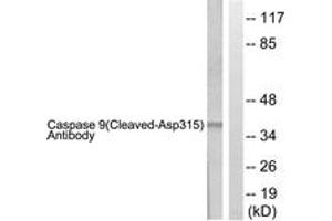 Western blot analysis of extracts from 293 cells, treated with Etoposide 25uM 60', using Caspase 9 (Cleaved-Asp315) Antibody. (Caspase 9 抗体  (Cleaved-Asp315))