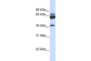 Western Blotting (WB) image for anti-Par-6 Partitioning Defective 6 Homolog beta (PARD6B) antibody (ABIN2458688) (PARD6B 抗体)