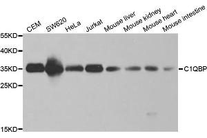Western blot analysis of extracts of various cell lines, using C1QBP antibody. (C1QBP 抗体)