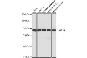 Western blot analysis of extracts of various cell lines, using SYVN1 antibody (ABIN1875011) at 1:1000 dilution. (SYVN1 抗体)