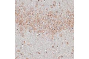 Immunohistochemistry of paraffin-embedded rat brain using TMX1 antibody  at dilution of 1:100 (40x lens). (TMX1 抗体  (AA 210-280))