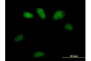 Immunofluorescence of purified MaxPab antibody to GSTO2 on HeLa cell. (GSTO2 抗体  (AA 1-243))