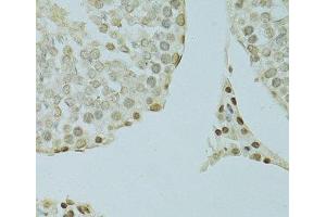 Immunohistochemistry (Paraffin-embedded Sections) (IHC (p)) image for anti-Scaffold Attachment Factor B (SAFB) antibody (ABIN7263975)