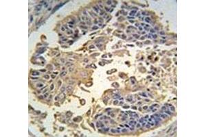 Immunohistochemistry (IHC) image for anti-Receptor-Interacting serine-threonine Kinase 3 (RIPK3) (AA 489-518) antibody (ABIN3032450)
