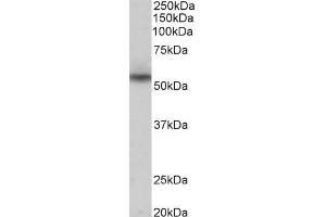 Western Blotting (WB) image for anti-MARE (C16orf35) antibody (ABIN5944454) (Mare/Nprl3/C16orf35 抗体)