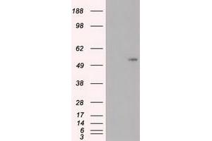 Image no. 7 for anti-Myc Proto-Oncogene protein (MYC) antibody (ABIN1497012) (c-MYC 抗体)
