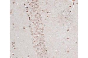 Immunohistochemistry of paraffin-embedded Mouse brain using ZNF177 Polyclonal Antibody at dilution of 1:100 (40x lens). (ZNF177 抗体)
