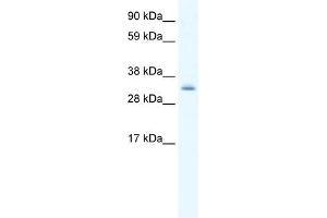 Western Blot showing PDLIM1 antibody used at a concentration of 1-2 ug/ml to detect its target protein. (PDLIM1 抗体  (Middle Region))