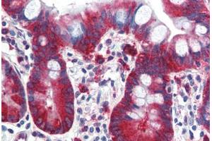 Human Small Intestine (formalin-fixed, paraffin-embedded) stained with TPD52L1 antibody ABIN364314 at 5 ug/ml followed by biotinylated anti-mouse IgG secondary antibody ABIN481714, alkaline phosphatase-streptavidin and chromogen. (TPD52L1 抗体)