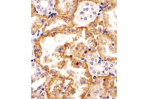 (ABIN6242877 and ABIN6578324) staining SLC22A2 in human kidney tissue sections by Immunohistochemistry (IHC-P - paraformaldehyde-fixed, paraffin-embedded sections). (SLC22A2 抗体  (N-Term))