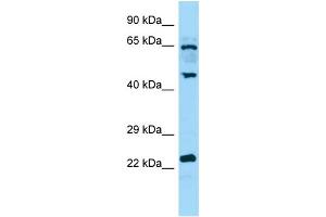 WB Suggested Anti-DUSP14 Antibody Titration: 1. (DUSP14 抗体  (C-Term))