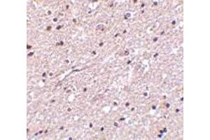 Immunohistochemistry of HAP1 in human brain tissue with HAP1 antibody at 2. (HAP1 抗体  (Center))