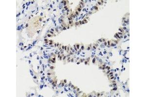 Immunohistochemistry (Paraffin-embedded Sections) (IHC (p)) image for anti-Signal Transducer and Activator of Transcription 3 (Acute-Phase Response Factor) (STAT3) (pSer727) antibody (ABIN7265216)