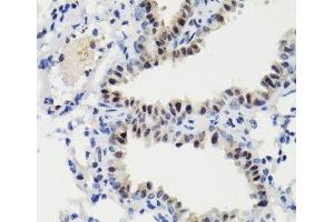 Immunohistochemistry of paraffin-embedded Mouse lung using Phospho-Stat3(S727) Polyclonal Antibody at dilution of 1:100 (40x lens). (STAT3 抗体  (pSer727))