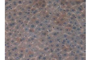 Figure. (CYR61 抗体  (AA 176-379))