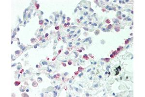 Anti-CYP2B6 antibody IHC staining of human lung. (CYP2B6 抗体  (AA 235-263))